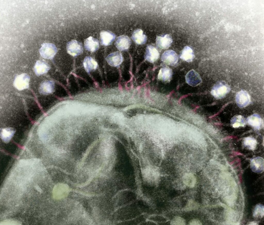A false-color transmission electron micrograph of multiple
bacteriophages attached to a bacterial cell wall
(Credit: Wikimedia Commons)